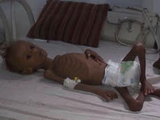 'We are besieged by hunger': Footage shows extent of child malnutrition in Yemen as Britain continues to sell arms to Saudi Arabia