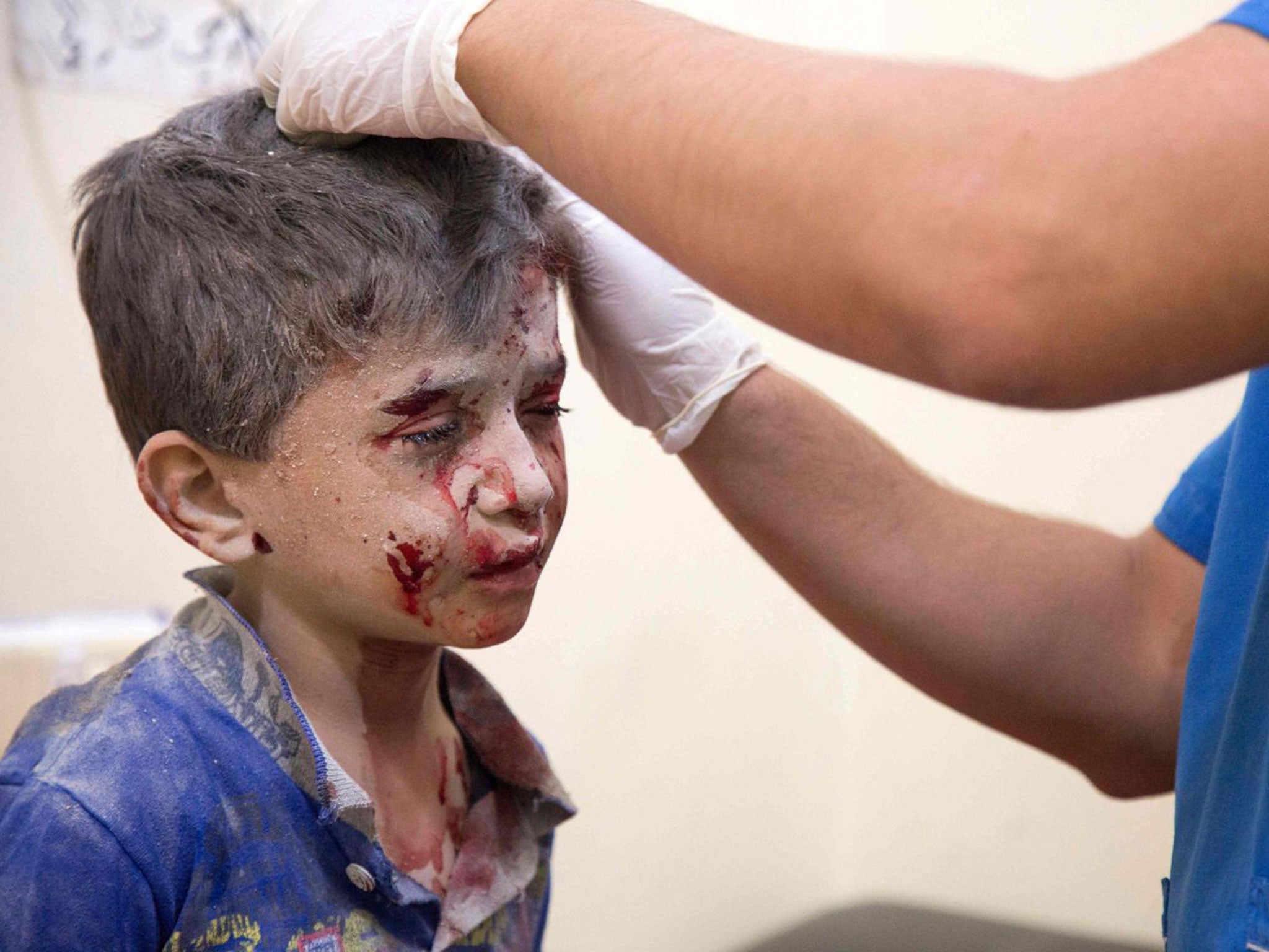 A Syrian boy receives treatment following air strikes on rebel-held eastern areas of Aleppo on Saturday