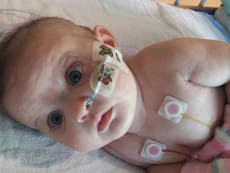 Parents of baby awaiting transplant plea for organ donors