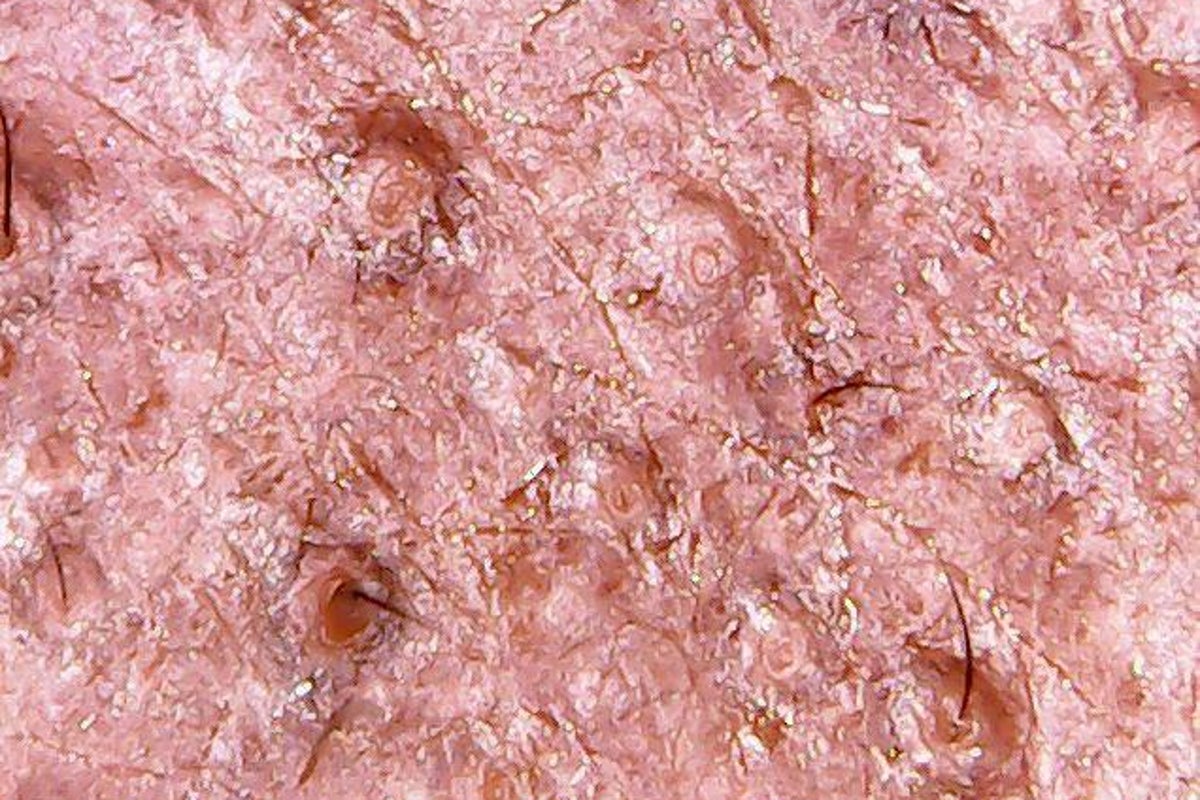 skin cells under light microscope