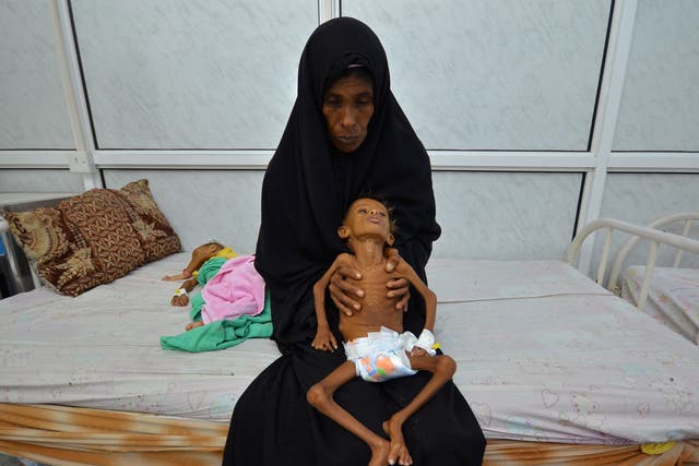 A six-year-old boy is held by his mother as she sits on a bed at a hospital in Hodaida, Yemen, September 2016. More than half of the country's 28-million strong population is suffering from food shortages, the UN says