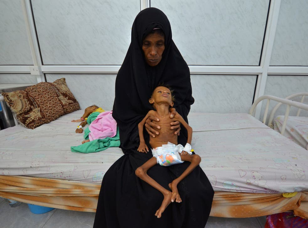 A six-year-old boy is held by his mother at a malnutrition intensive care unit at a hospital in Hodaida