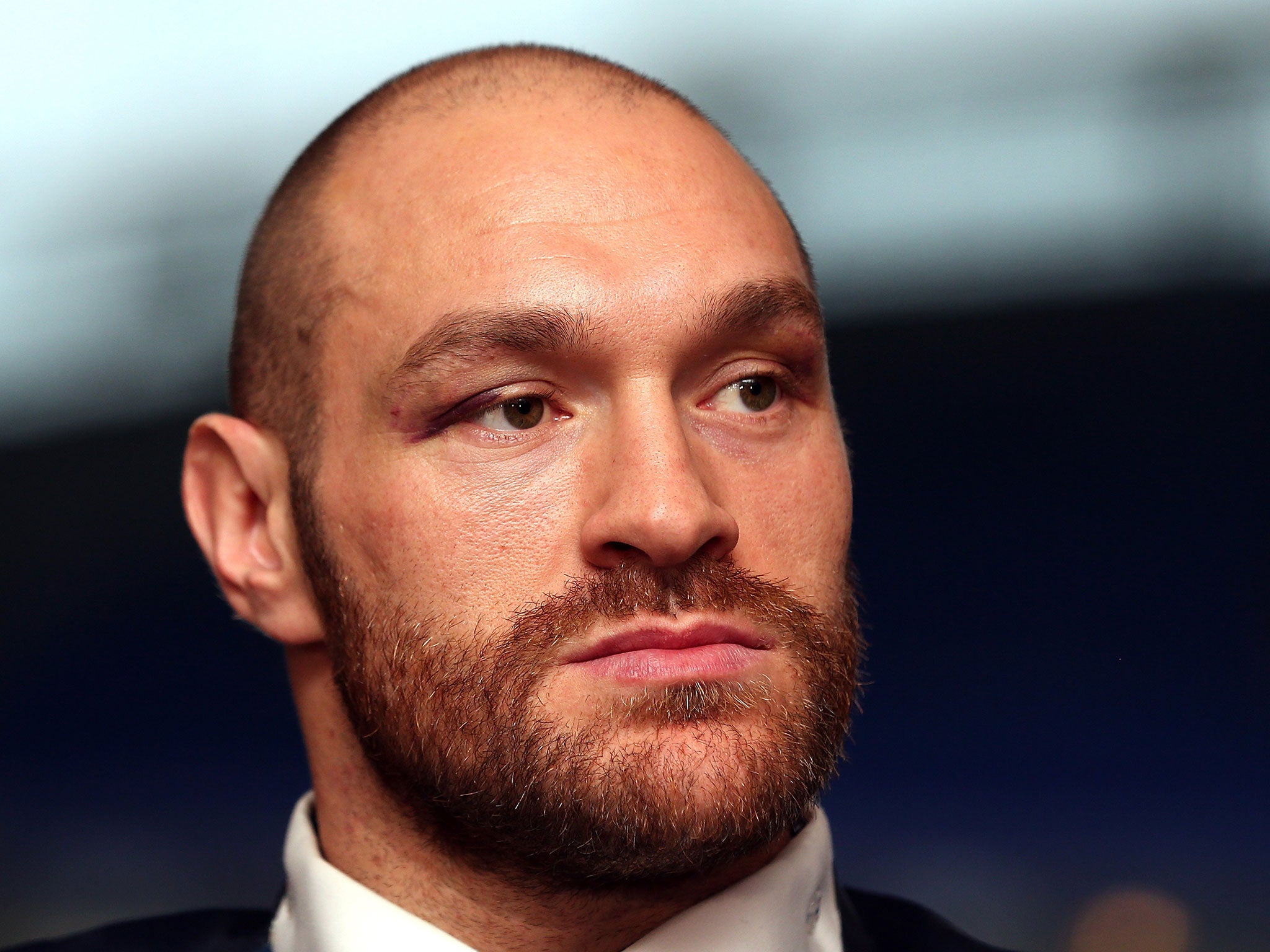 Tyson Fury could lose his license to fight