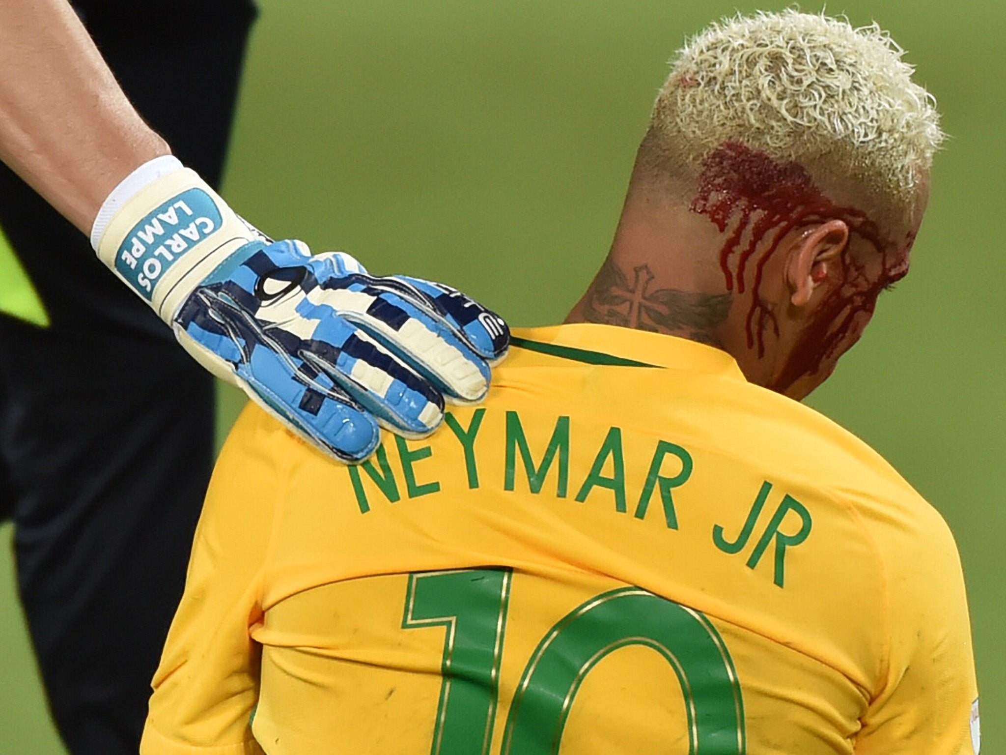 Neymar was left with a bloodied face after the clash
