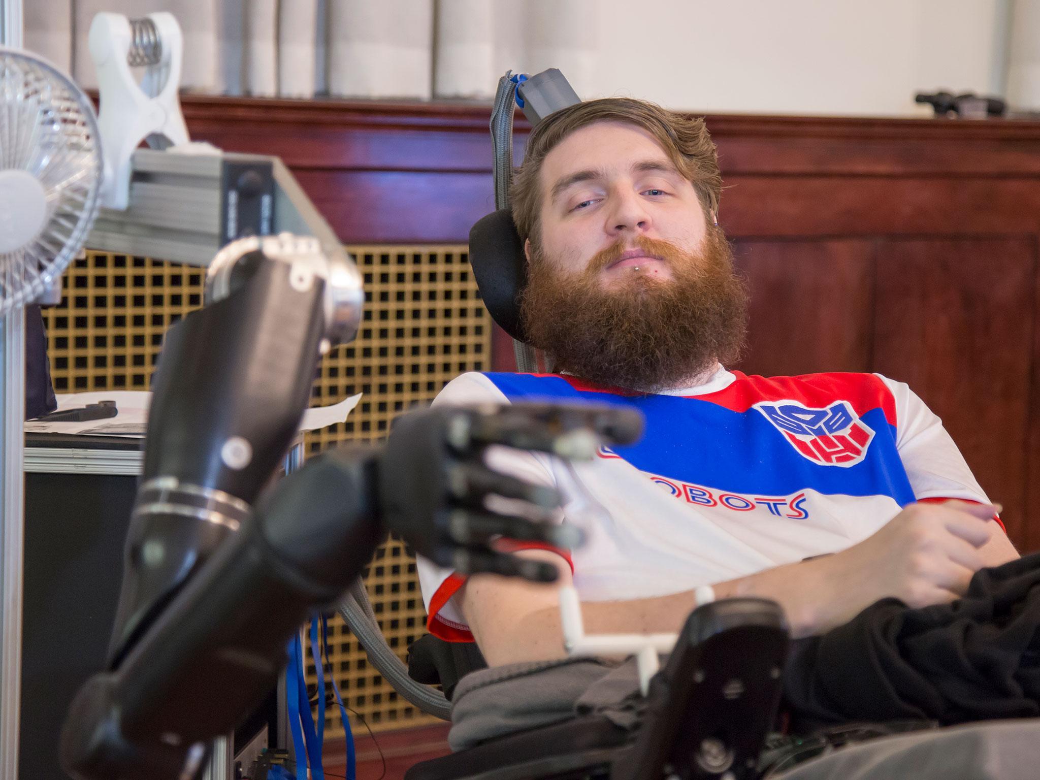 Nathan Copeland has implants in his brain connected to the robotic arm