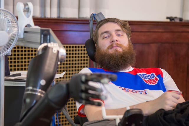 Nathan Copeland has implants in his brain connected to the robotic arm