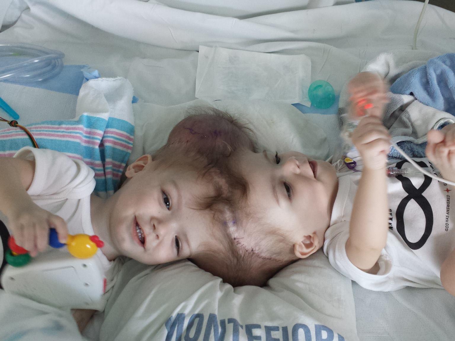 Conjoined twins open up about sex life   — Australia's leading  news site