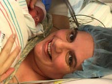 Baby girl 'born twice' due to groundbreaking operation