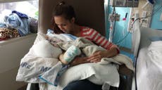 Mother holds formerly conjoined twin for first time after surgery