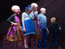 The world's first albino beauty contest held in Kenya