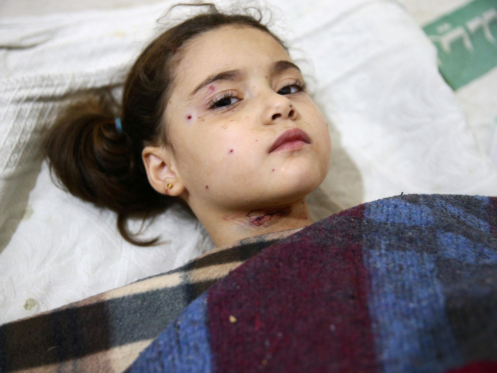 An injured girl rests in a field hospital after an air strike on a nursery in the rebel-held besieged city of Harasta, in the eastern Damascus suburb of Ghouta, Syria, 6 November, 2016.