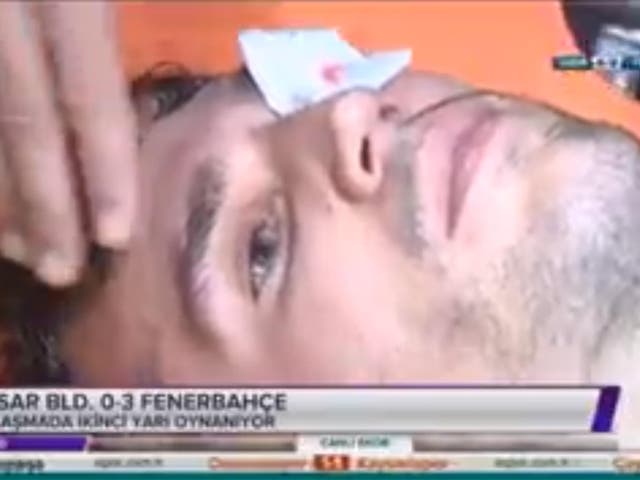 Van Persie received treatment on the eye after being carried off the pitch