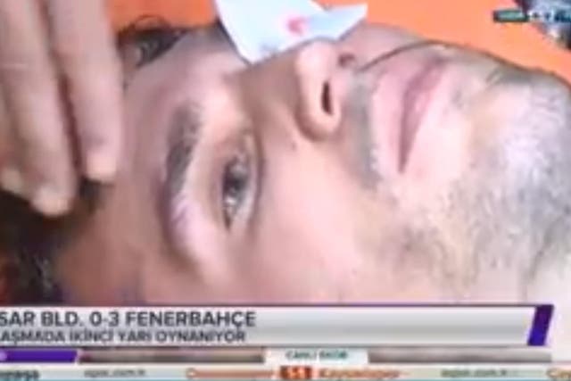 Van Persie received treatment on the eye after being carried off the pitch