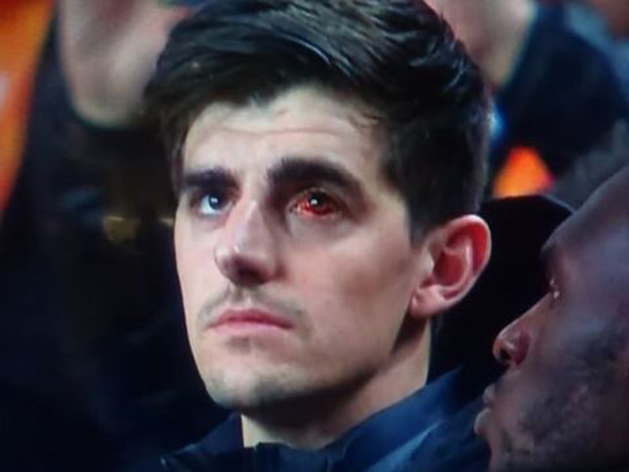 Courtois' bloodshot eye was captured by television cameras