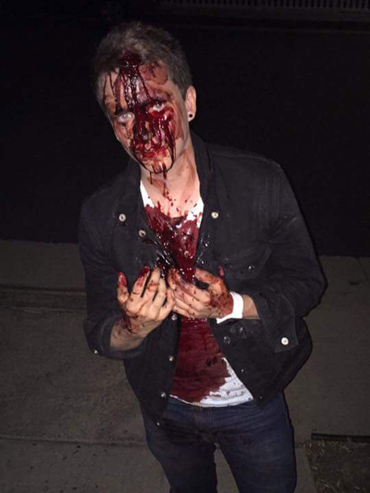 Chris Ball, a fim producer from Calgary, was attacked by men shouting homophobic slurs in Santa Monica on the night of the US election