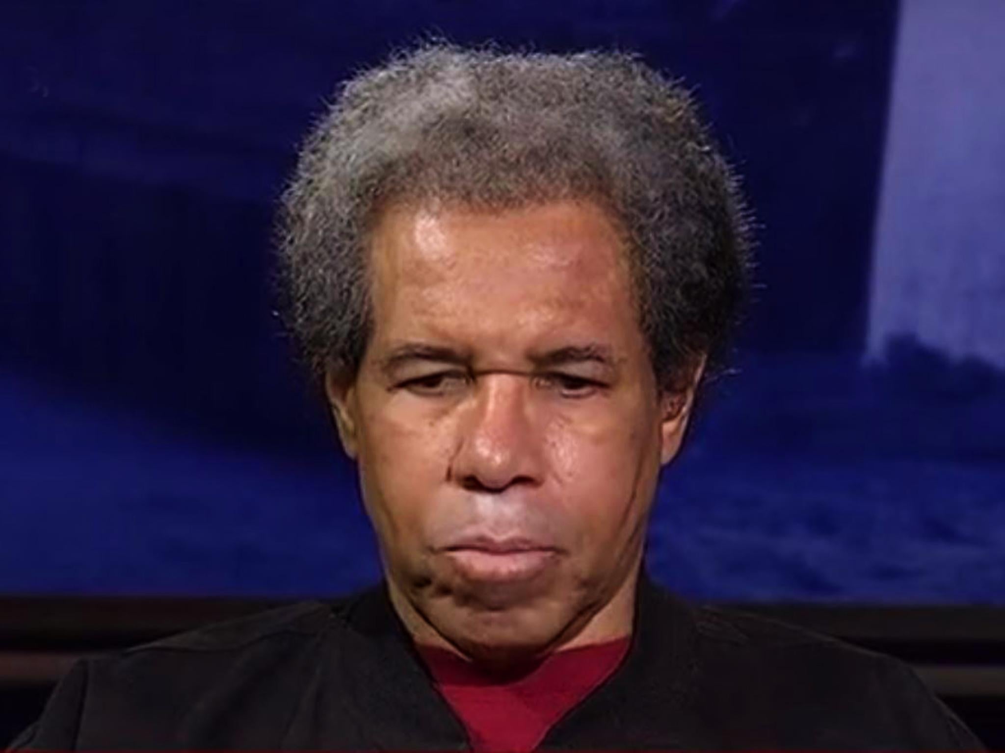 Albert Woodfox says he has never received a formal apology from the US government