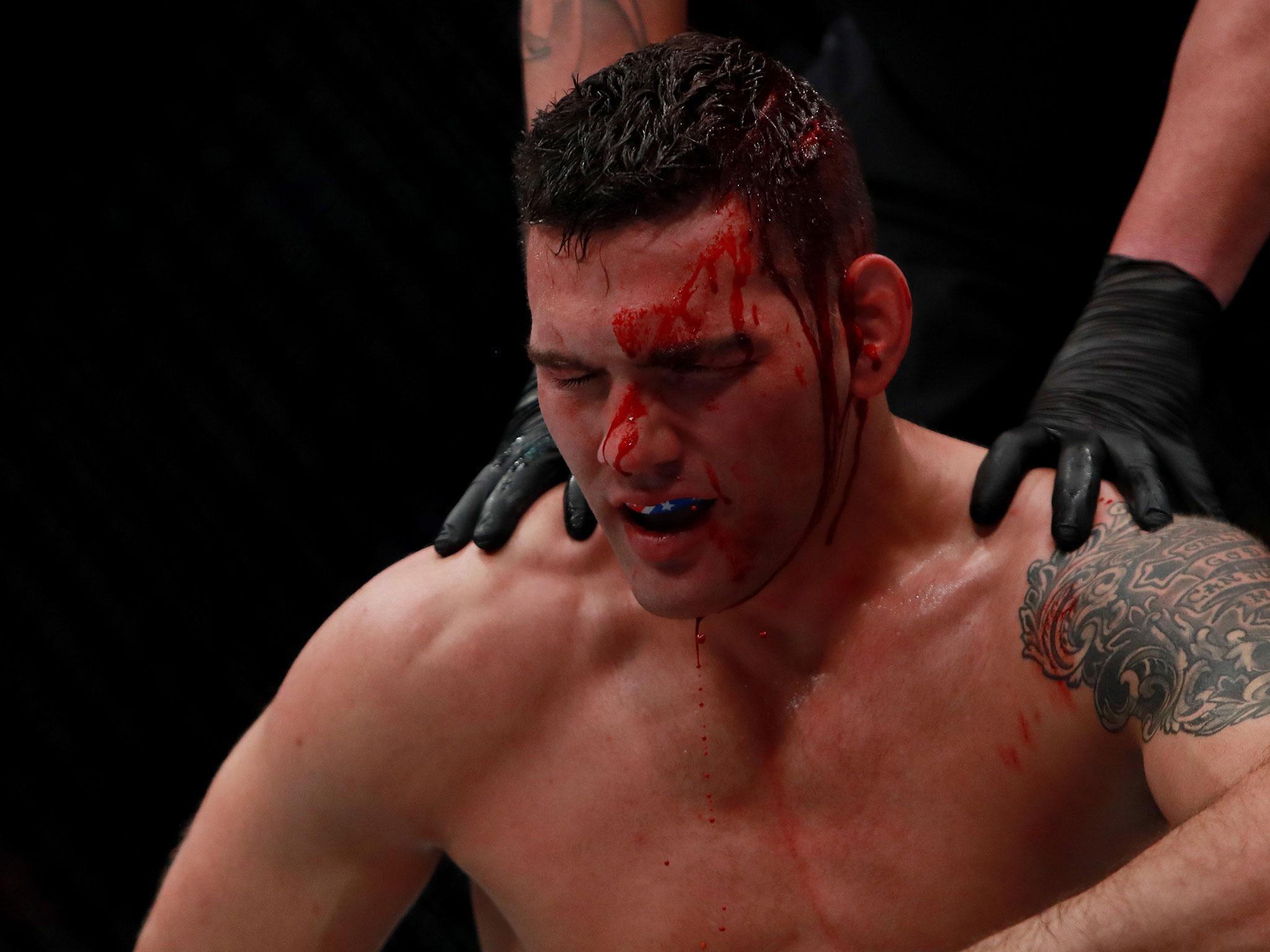 Weidman was left hurt and bloodied by the knee