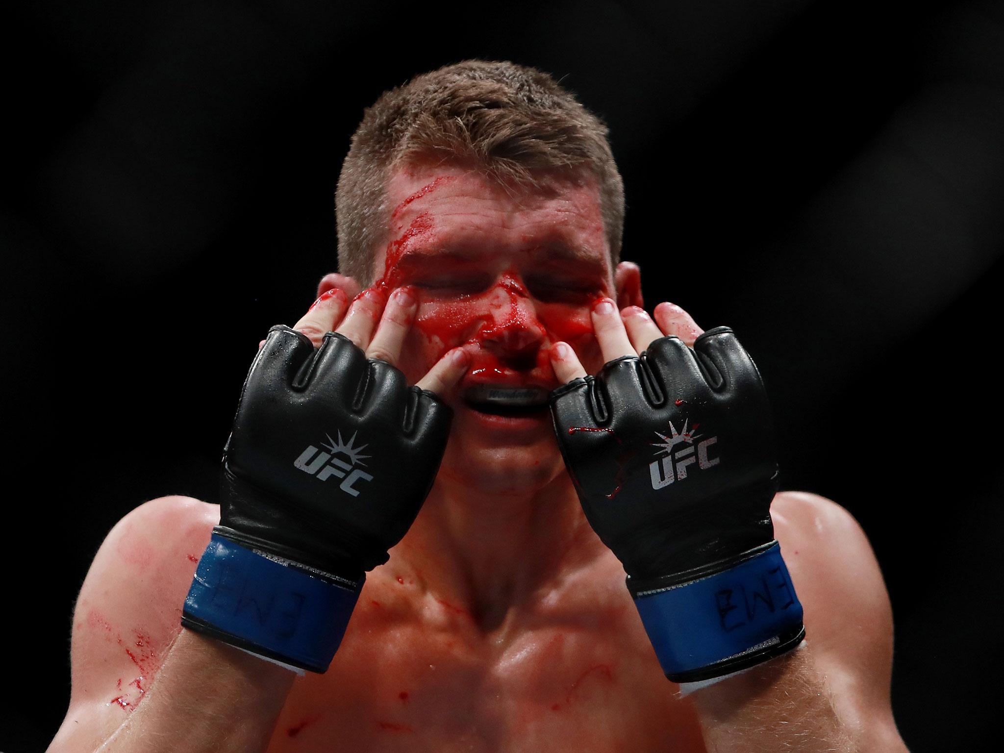 Thompson was busted open by the end of the first round