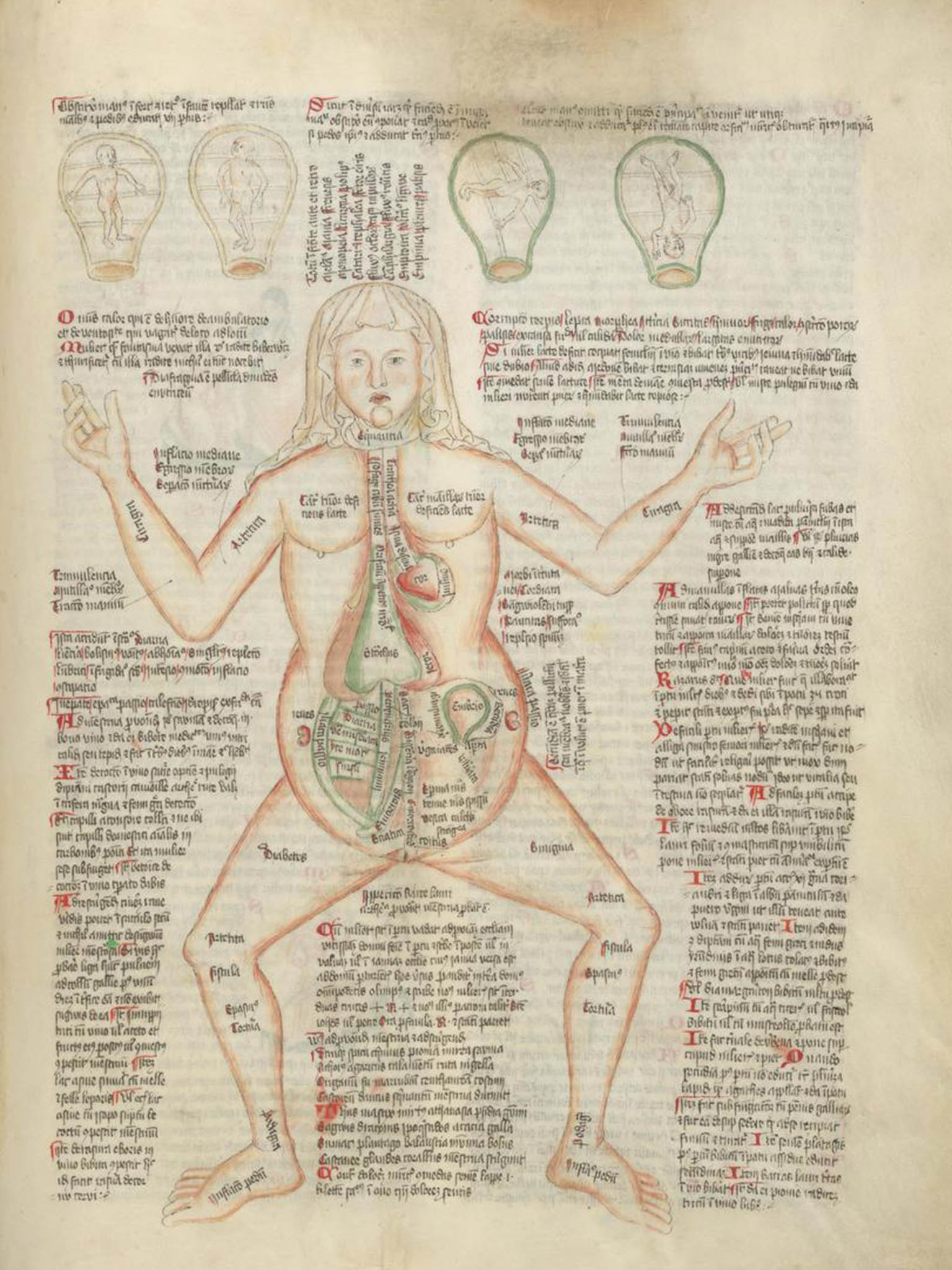 The ‘Disease Woman’ according to 15th century physicians