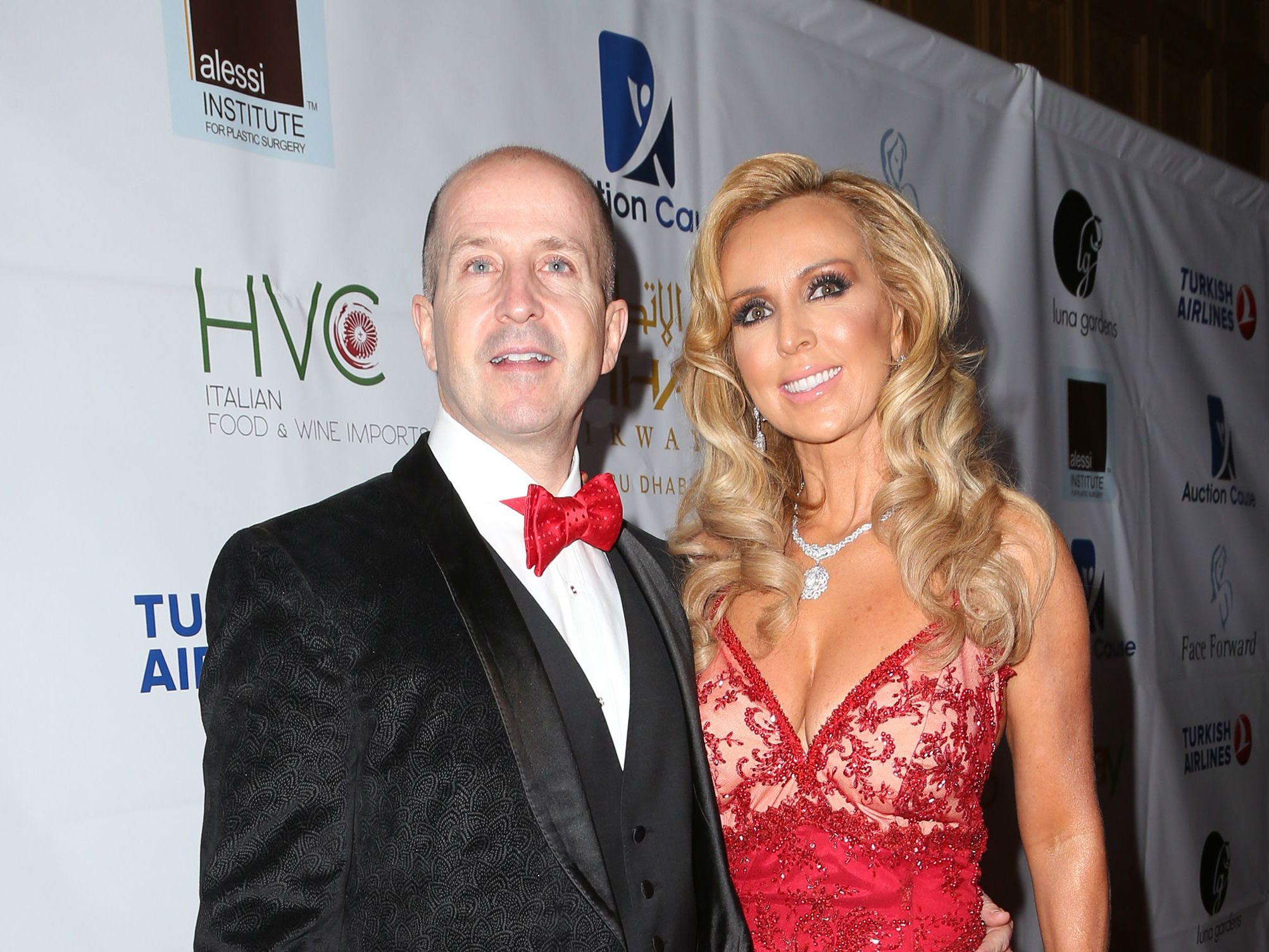 David and Deborah Alessi at the 6th annual Face Forward gala in Los Angeles in September 2015