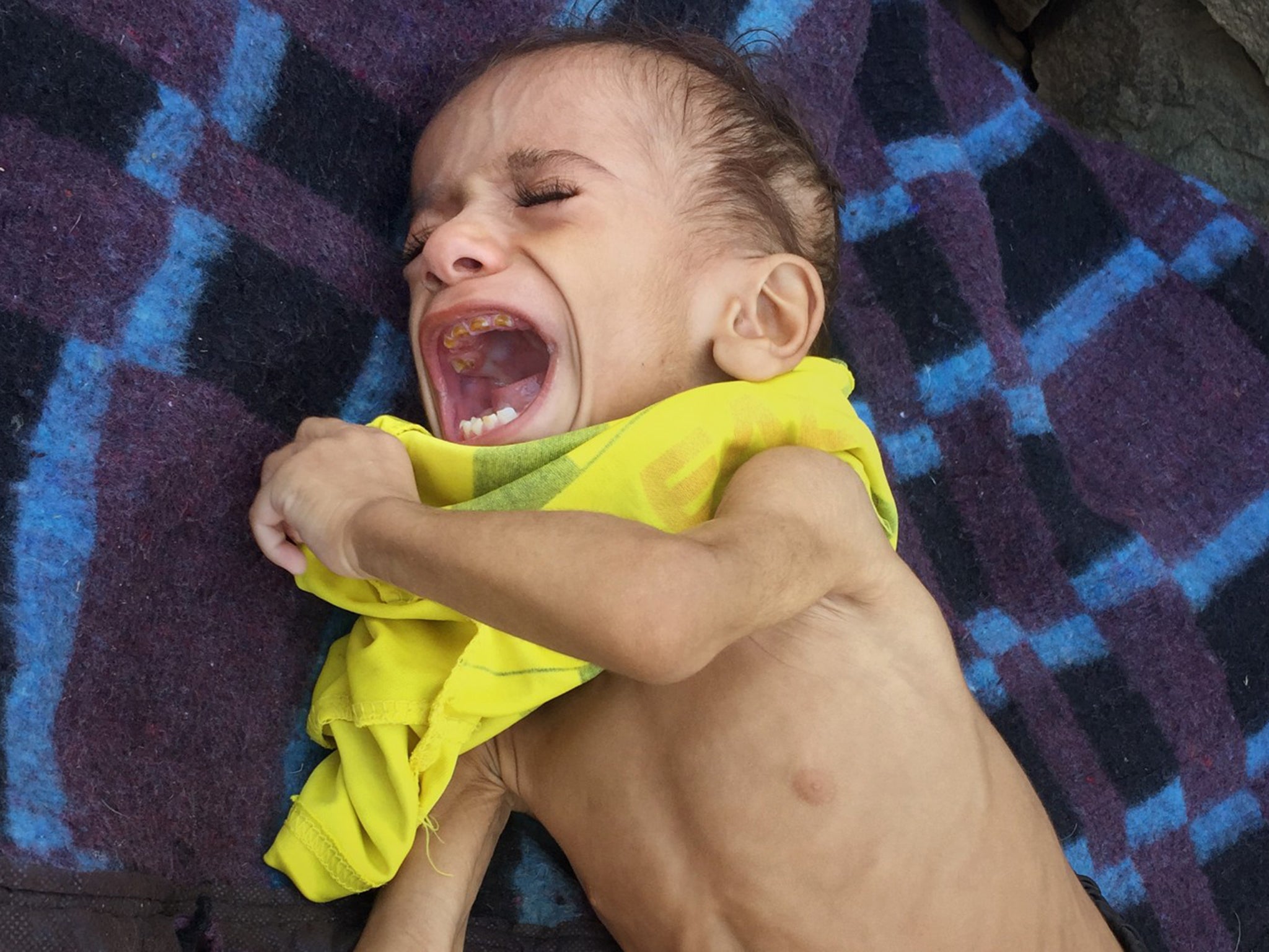 Osama Hassan suffers from severe hunger in Bani Saifan, Yemen