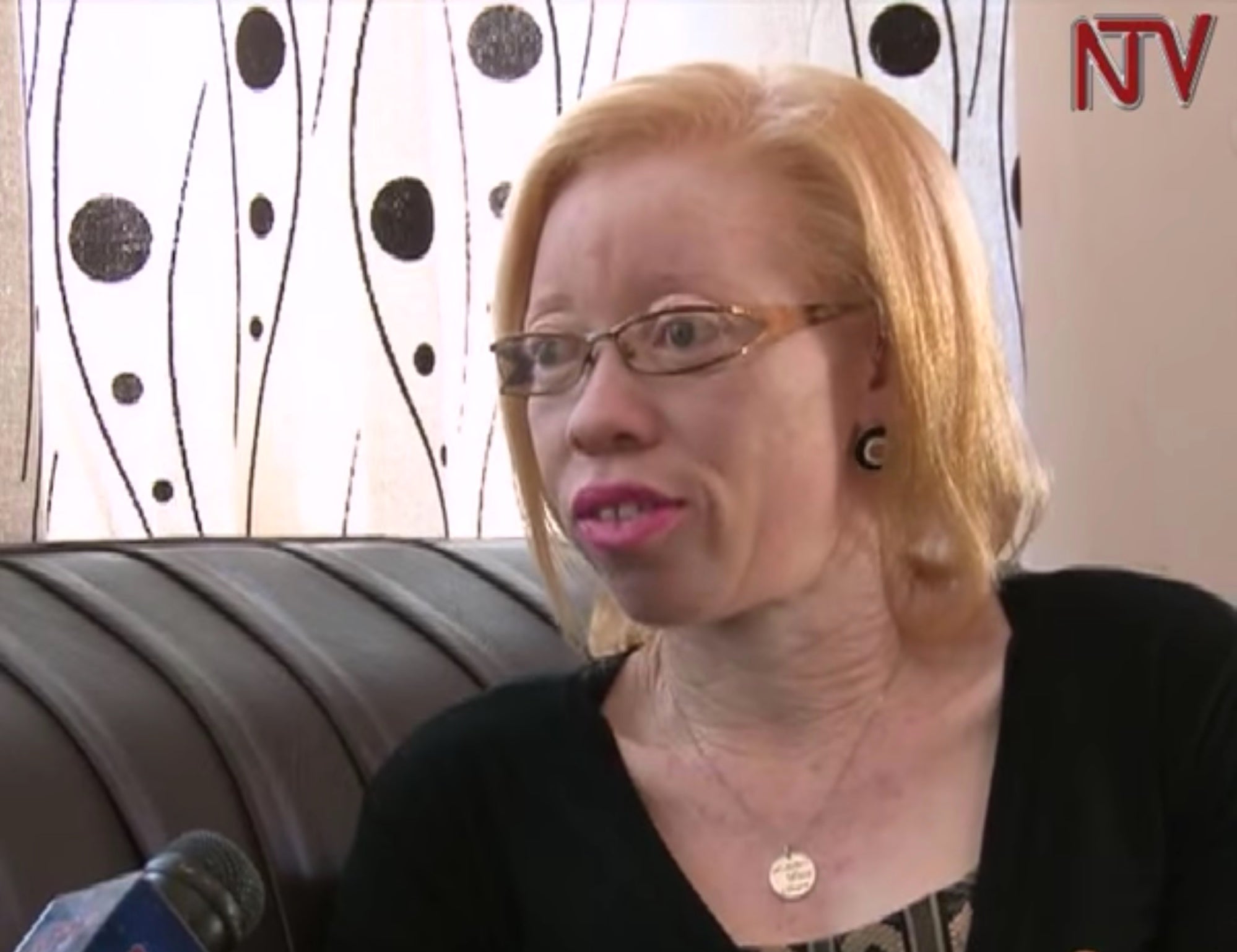 Olive Namutebi works to champion the rights of people with albinism, and has been interviewed in the past by NTV Uganda