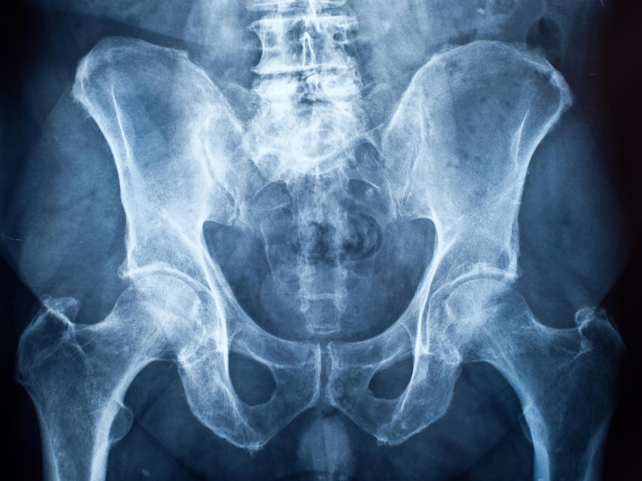 Humans have no penis bone because sex doesnt last long enough, scientists discover The Independent The Independent pic