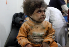 Aleppo's children are 'so traumatised they have stopped crying'