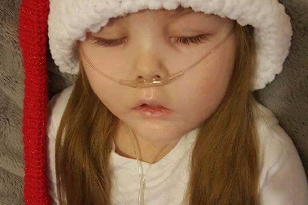 Ezmae Catley suffered from a variety of medical conditions, including brain damage, dystonia, and cerebral palsy