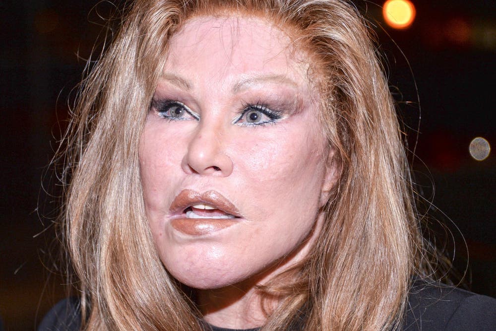 Jocelyn Wildenstein shares throwback photo with her daughter The Jocelyn Wildenstein shares throwback photo with her daughter The