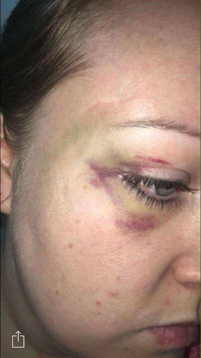 &#13;
Ms James’ family released images of injuries allegedly inflicted by her husband &#13;