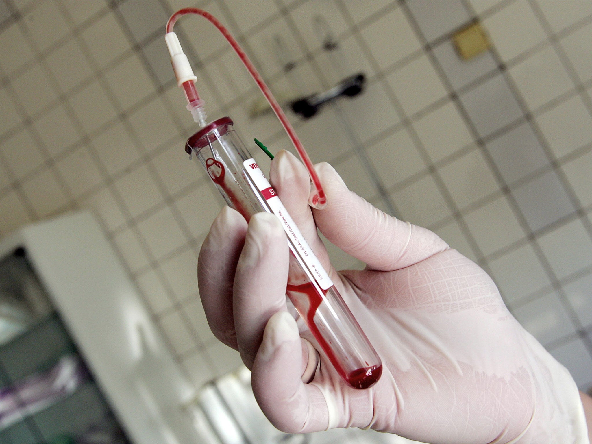 A nurse holding a test-tube with HIV positive blood in an infectious diseases hospital in Moscow