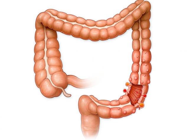 Why Do We Have An Appendix Scientists Have Discovered Its Purpose And It S Really Important
