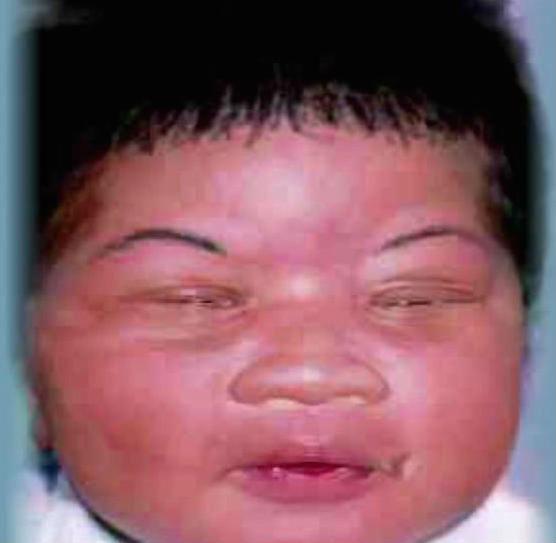 A facial composite released by police in 1998 shows what Kamiyah Mobley looked like as a newborn