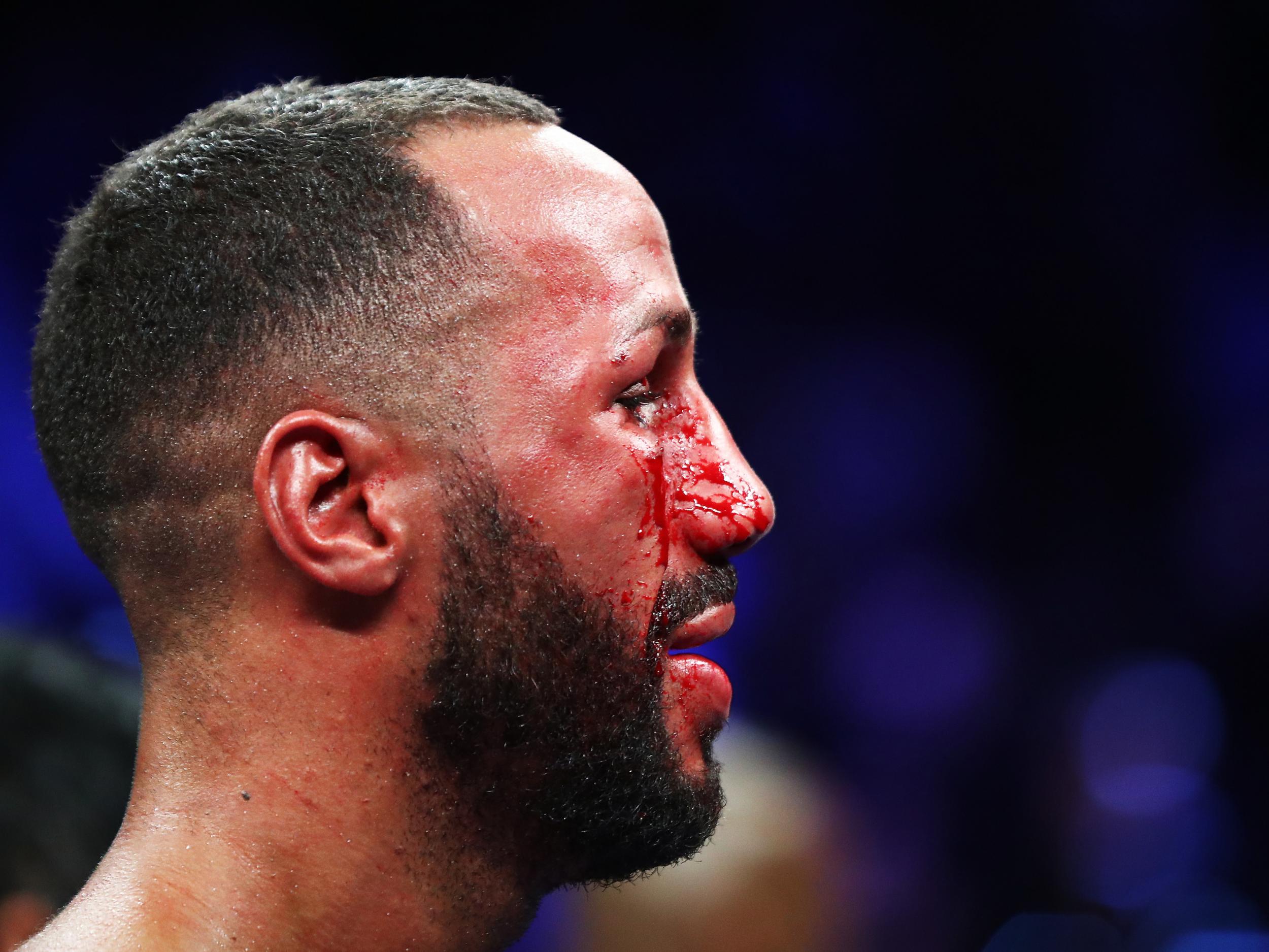 DeGale was cut under his eye