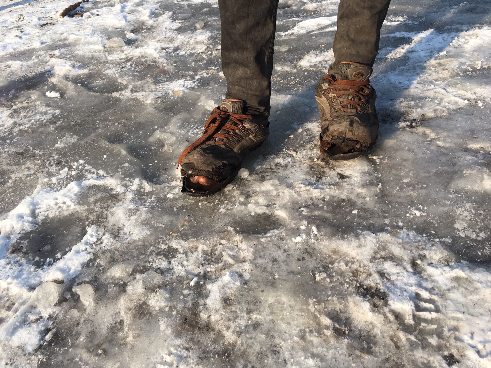 A homeless refugee in Belgrade is pictured with their toes poking out of their tattered footwear in freezing conditions