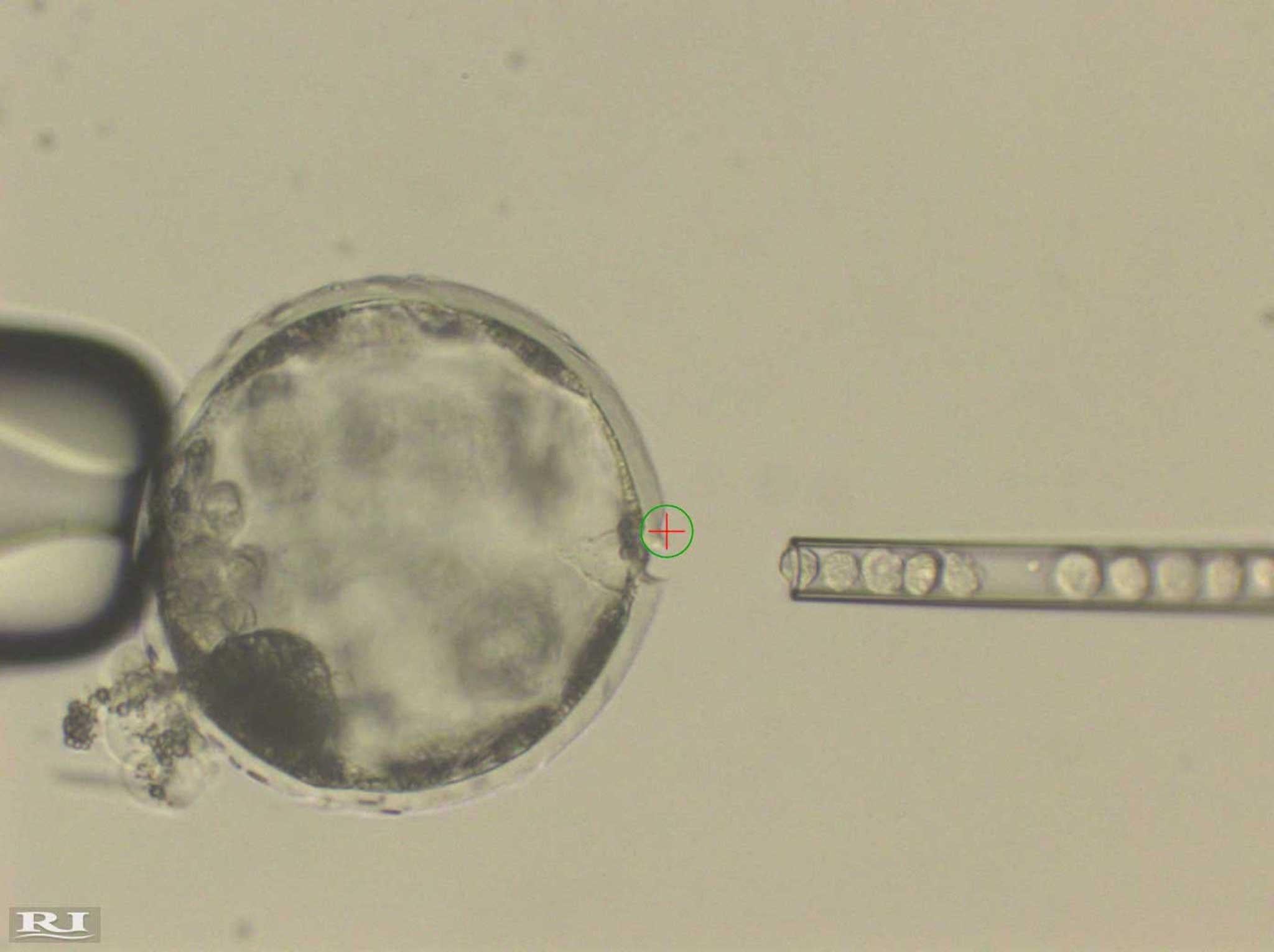 This photograph shows injection of human iPS cells into a pig blastocyst