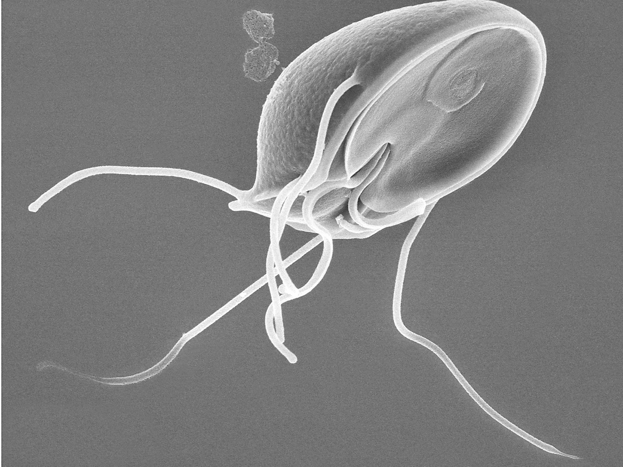 The protozoan parasite Toxoplasma gondii can infect humans if they come into contact with cat faeces or eating uncooked meat (Stan Erlandsen/Creative Commons)