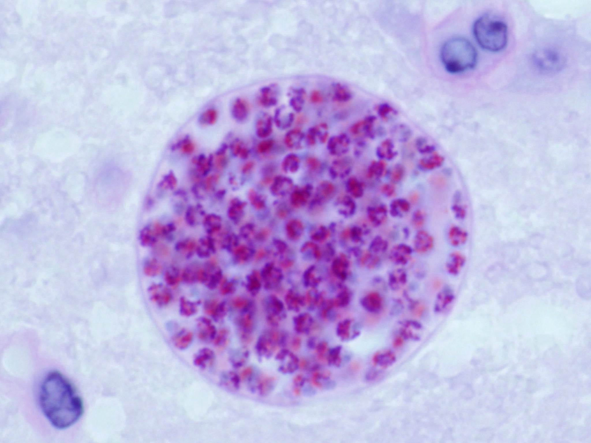 Microscopic cysts containing Toxoplasma gondii develop in the tissues of many vertebrates (Jitinder P Dubey/Creative Commons)