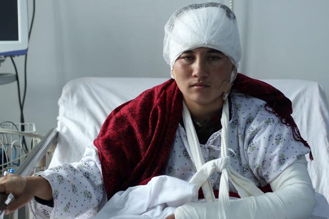 Afghan 23-year old Zarina, whose husband cut off her ears after accusing her of speaking to strange men, receives medical treatment at local hospital in Mazar-e-Sharif, Afghanistan, 3 February, 2017