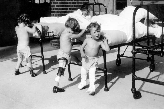Children with polio doing physiotherapy exercises at Wingfield Nuffield Orthopaedic Hospital in Oxfordshire