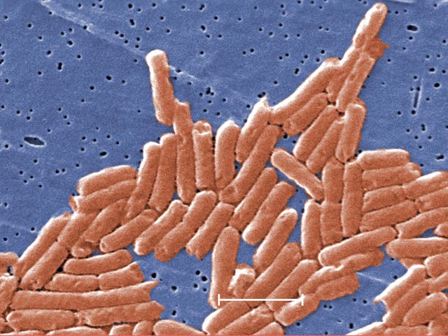 <p>CDC have reported two outbreaks of salmonella  </p>