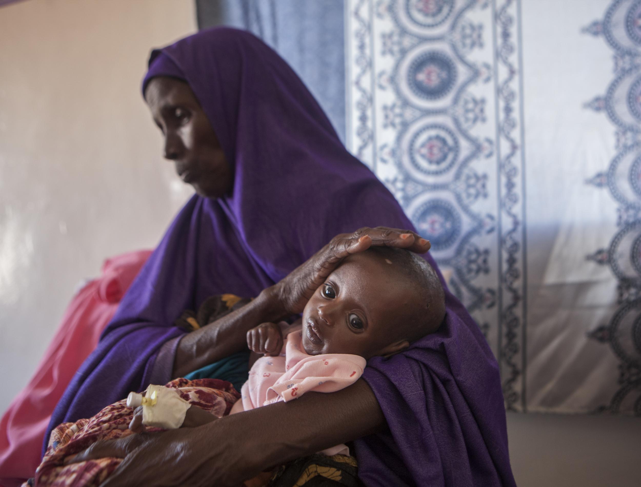 Three-month old Abshir, pictured at Garowe General Hospital in Puntland, Somalia, is suffering from malnutrition-related complications