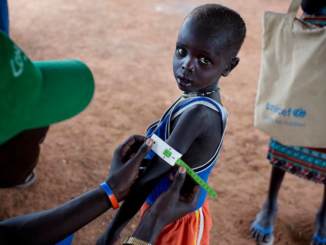 More than 250,000 Sudanese children are severely malnourished, according to experts