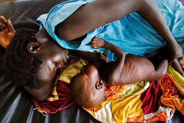 A mother breastfeeds her child, who is suffering from acute malnutrition, at a Doctors without Borders clinic in South Sudan