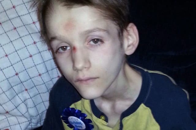 Alexandru, 15, died after suffering for years due to untreated diabetes and starvation