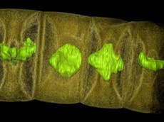 Student discovers world's oldest plant fossil