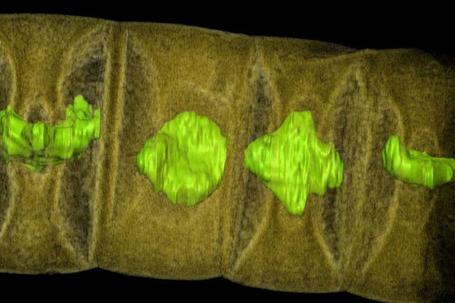 An X-ray image of fossilised red algae, highlighted in green