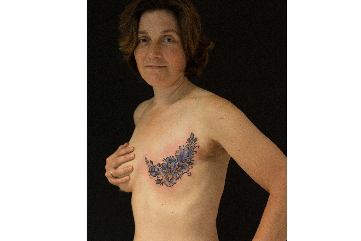 Tattoo Scarring Is It Normal and How to Fix Everything You Need to Know   Saved Tattoo