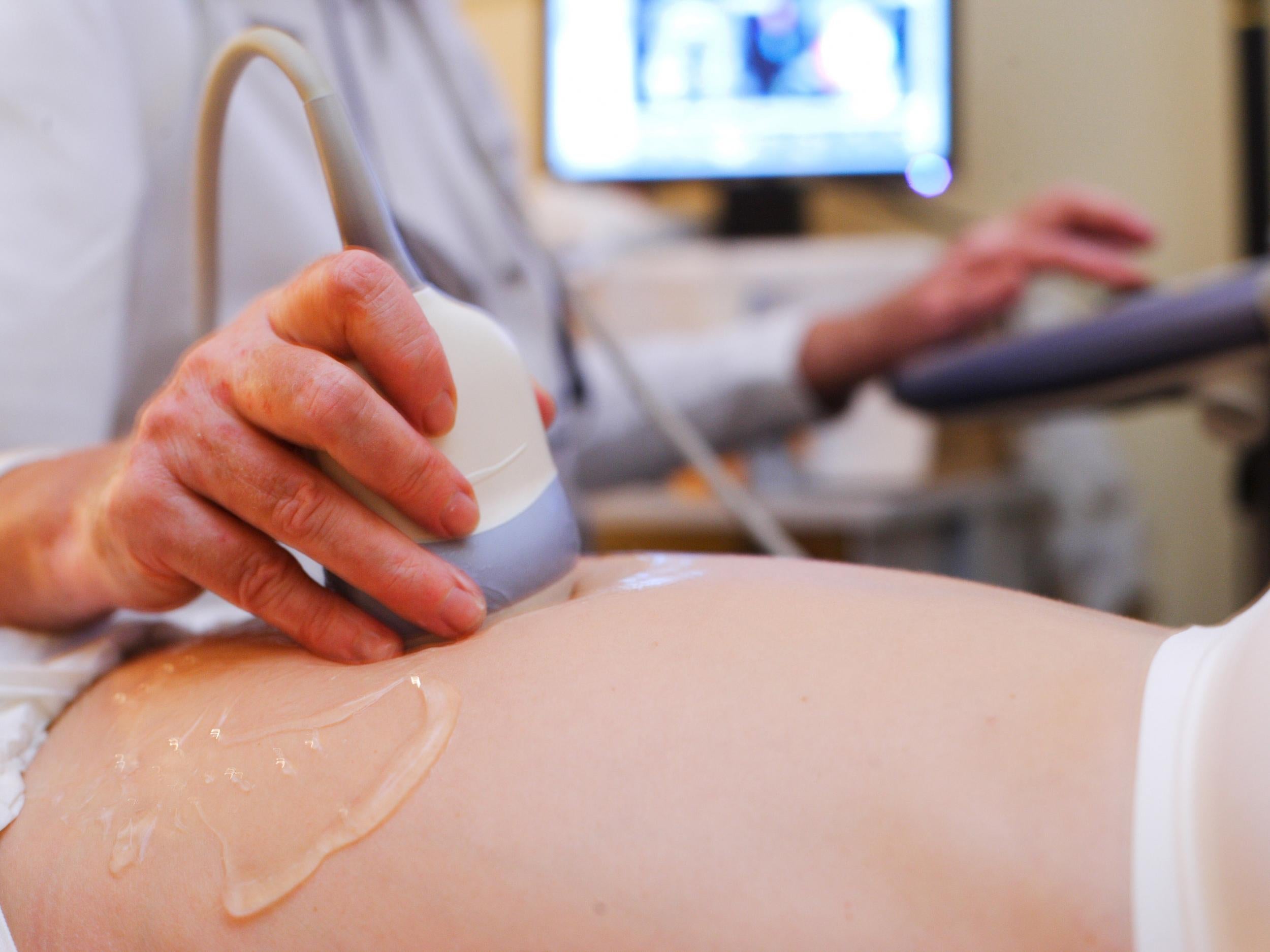 UK is one of few European countries not to offer a late-term ultrasound scan